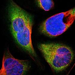 TR alpha/NR1A1/Thyroid Hormone Receptor alpha Antibody, Novus Biologicals